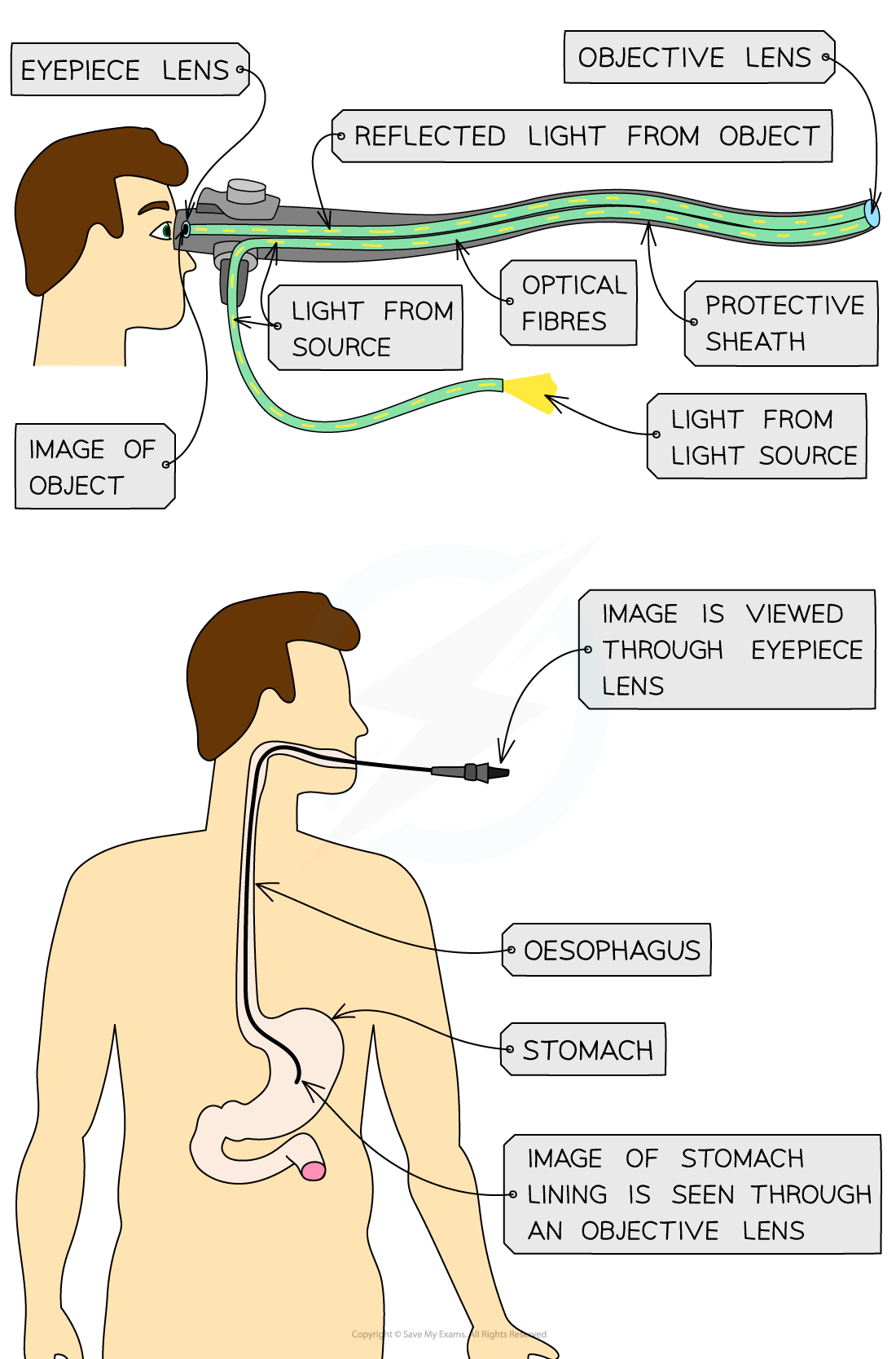 Endoscope, IGCSE & GCSE Physics revision notes