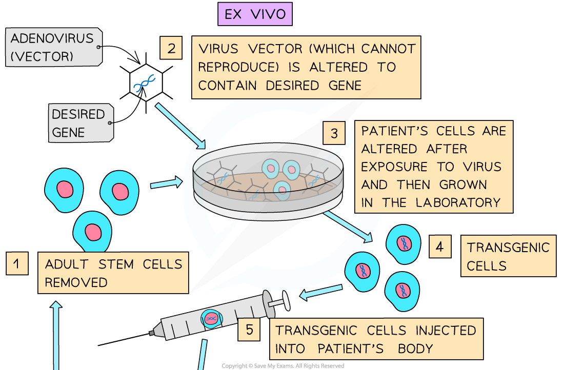 Gene therapy (1), downloadable AS & A Level Biology revision notes