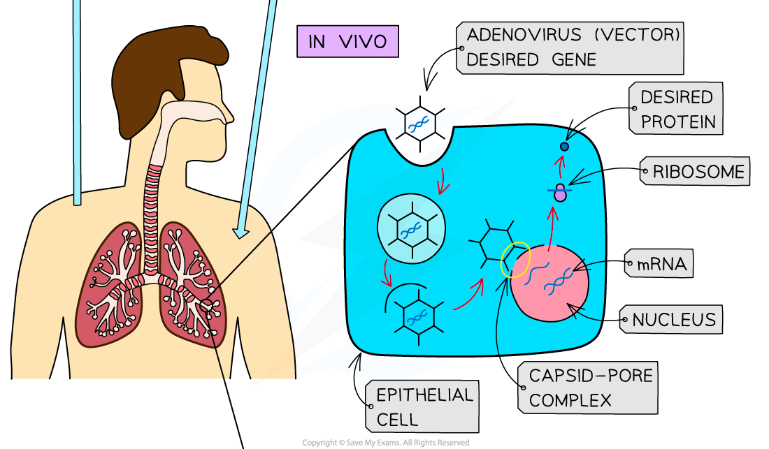 Gene therapy (2), downloadable AS & A Level Biology revision notes