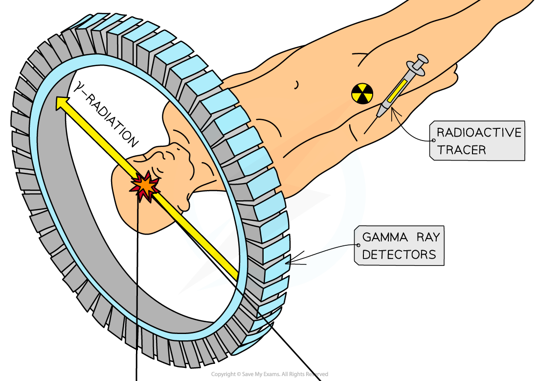 PET Scanning Machine (1), downloadable AS & A Level Physics revision notes