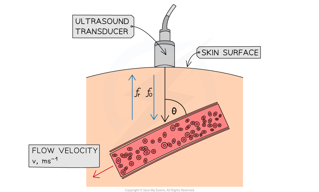 6-13-5-ultrasound-doppler-imaging_ocr-al-physics