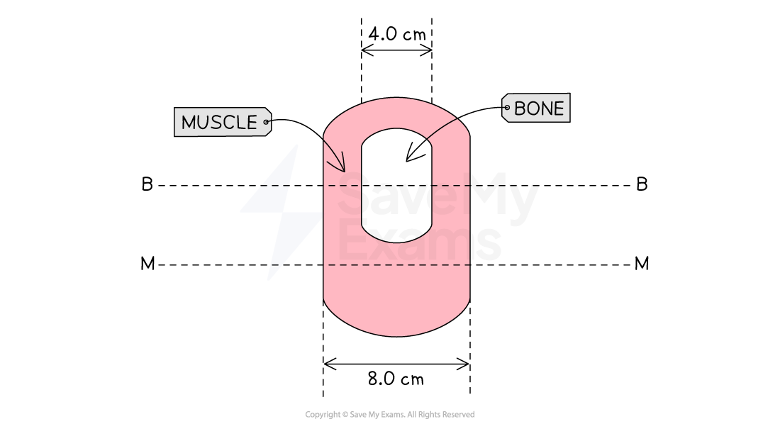 10-5-5-we-attenuation-of-x-rays-in-matter