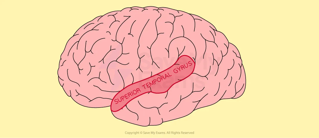 Illustration of a human brain highlighting the superior temporal gyrus in pink with a red outline on a light yellow background.