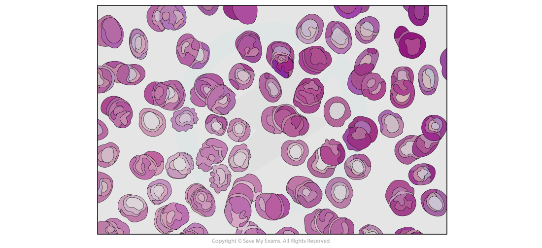 Illustration showing a collection of pink and purple circular shapes resembling a microscopic view of red blood cells, scattered on a white background.