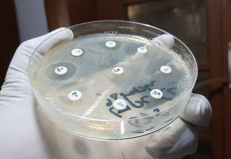 Gloved hand holding a petri dish with antibiotic discs on bacterial culture, showing zones of inhibition around some discs in a lab setting.