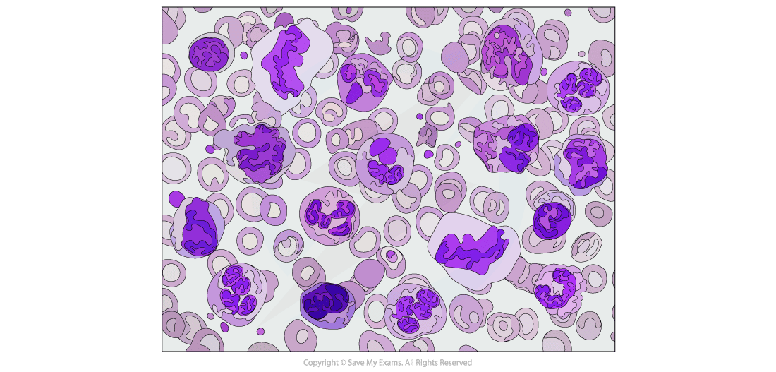 A micrograph of some lymphocyte cells