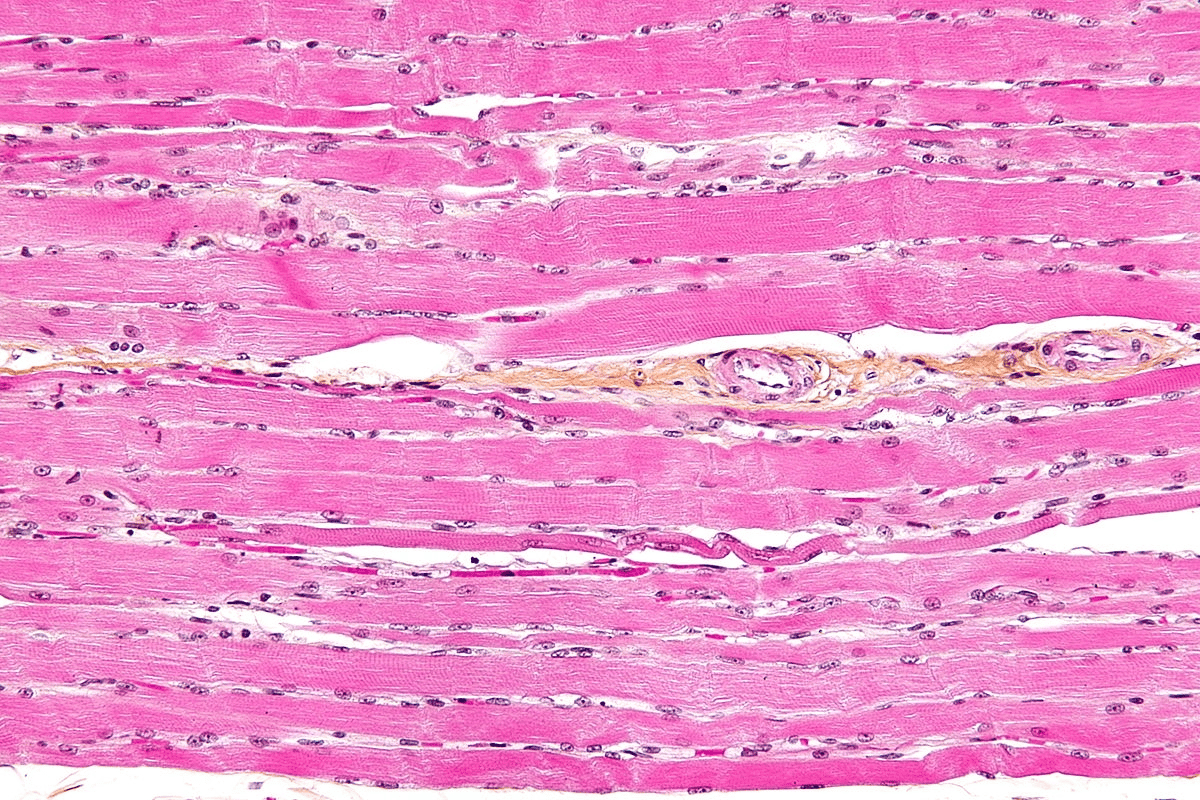 Histological slide of skeletal muscle tissue showing elongated muscle fibres in pink with multiple nuclei, and visible striations and connective tissue.