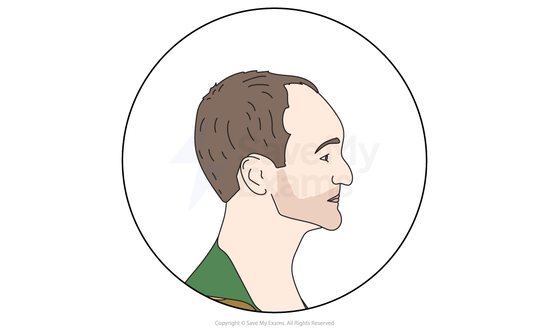 Illustration of a man's side profile within a circle, showing short brown hair and a green shirt on a plain white background.