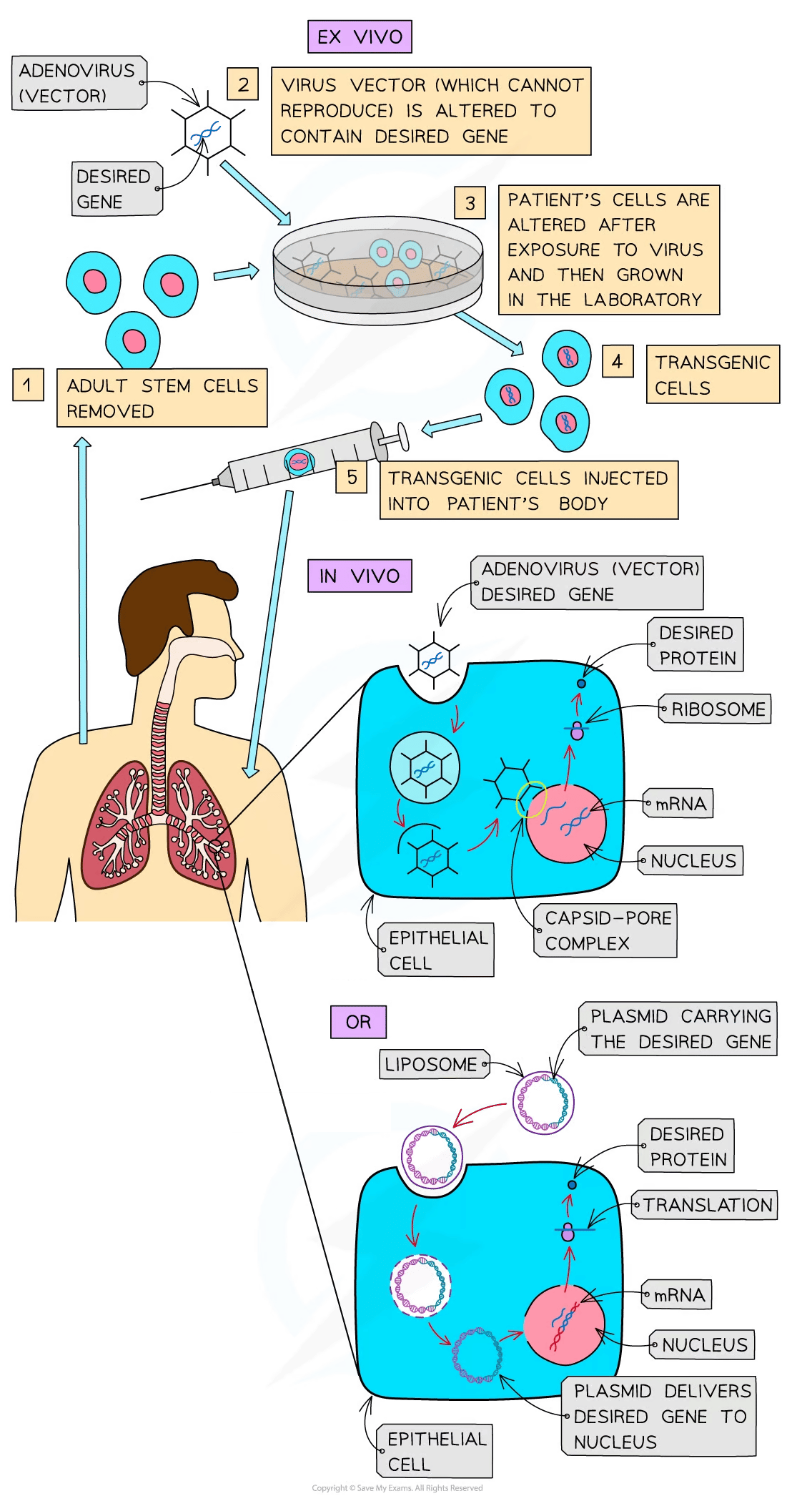 Diagram explaining ex vivo and in vivo gene therapy. Shows steps of using adenovirus vectors or liposomes to introduce desired genes into cells.