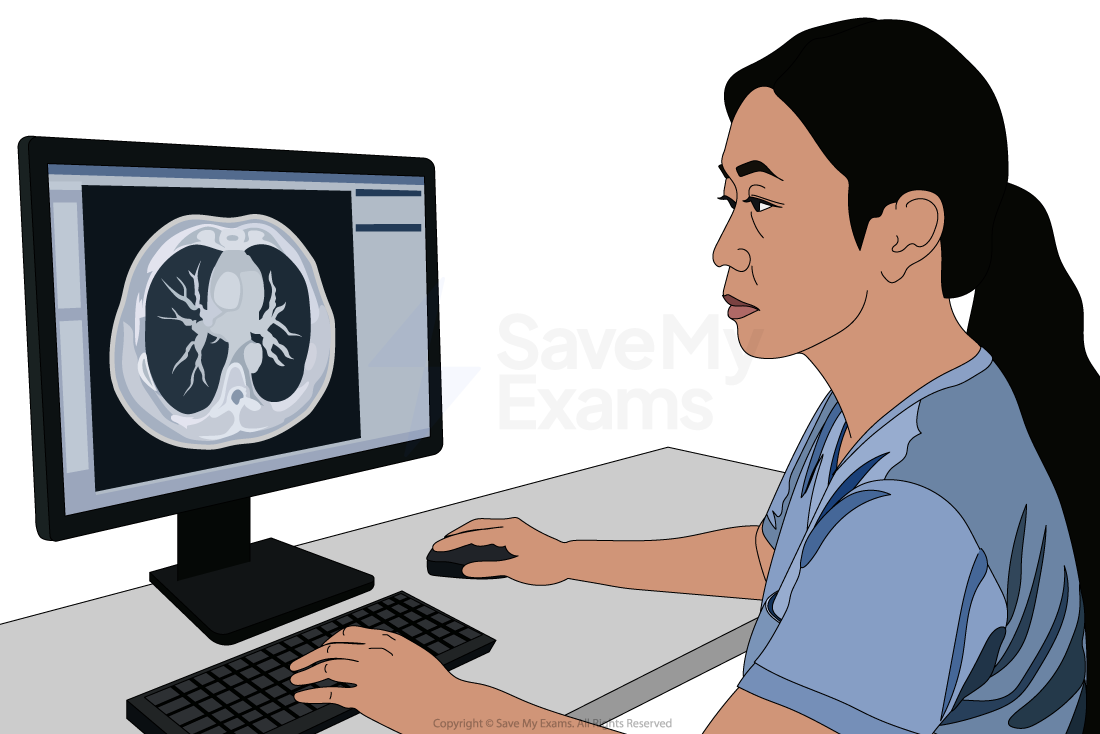 A person in medical scrubs examines a lung scan on a computer monitor, sitting at a desk with a keyboard and mouse.