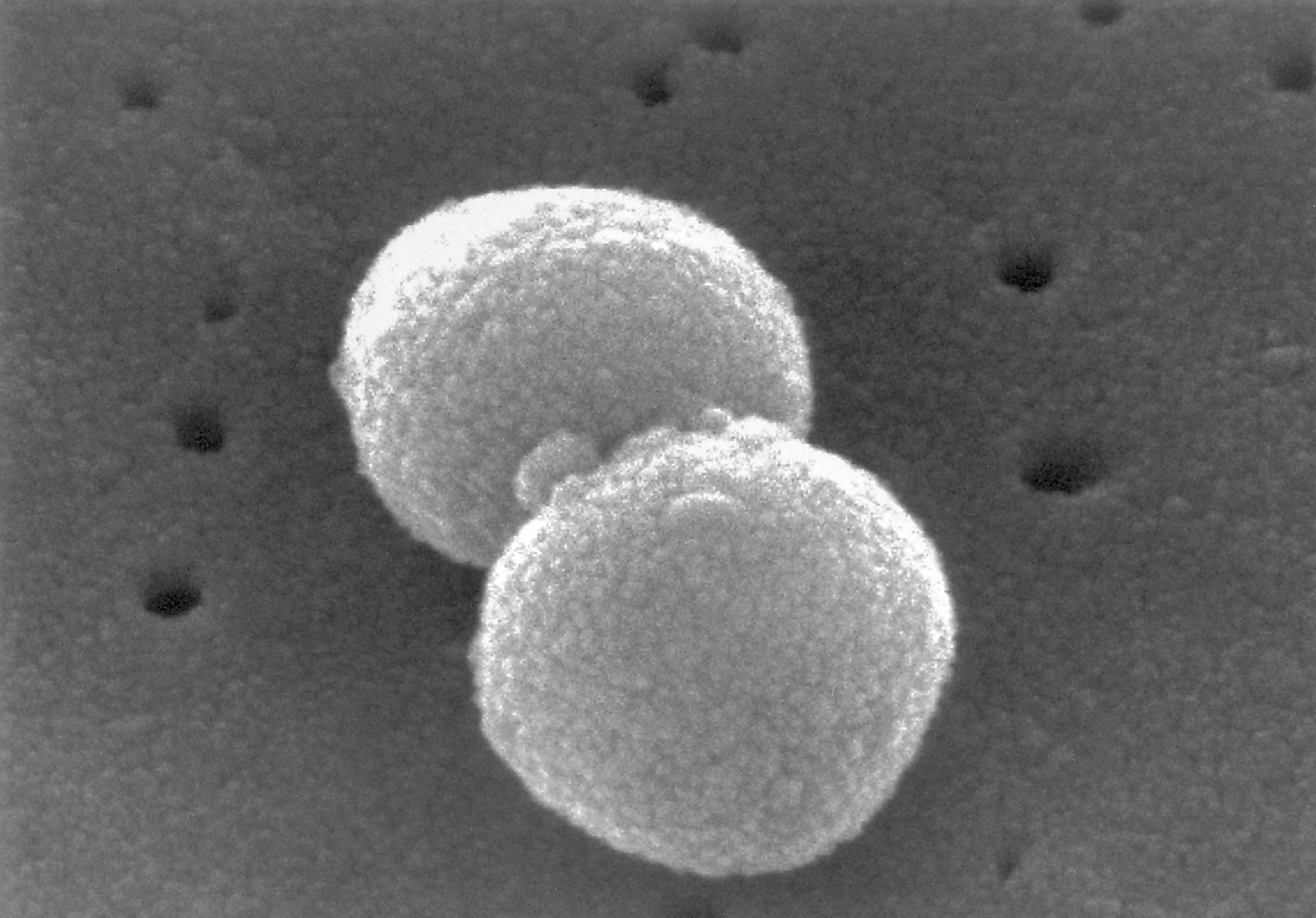 Microscopic view of two spherical bacterial cells with textured surfaces on a dark, uneven background with scattered circular pits.