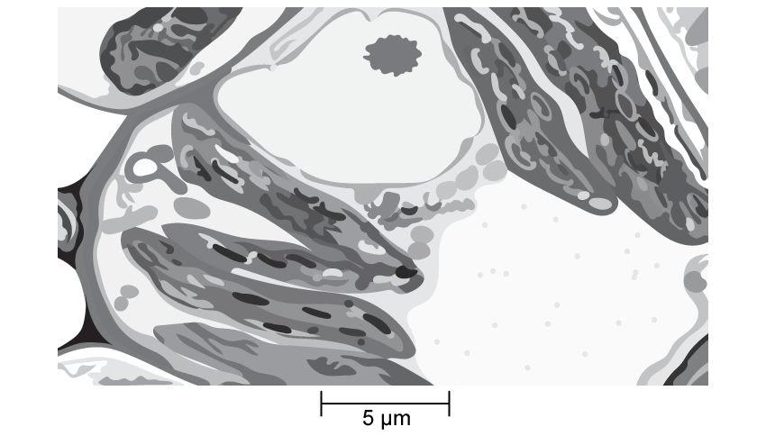 Electron micrograph showing plant cell organelles, including chloroplasts and mitochondria. Scale bar at bottom indicates 5 micrometres.