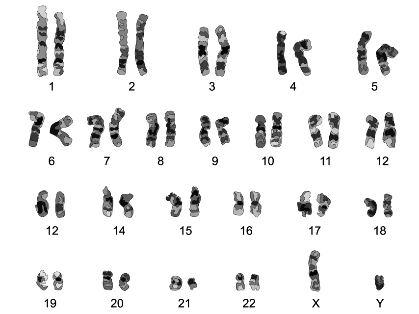 Image of a human karyotype showing 22 pairs of numbered chromosomes and a pair of sex chromosomes marked X and Y, each with unique banding patterns.