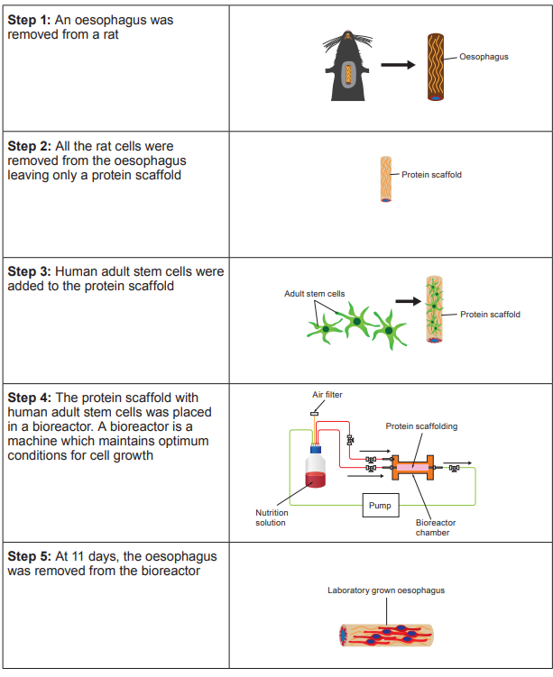 Steps showing oesophagus regeneration: rat oesophagus removal, cell removal, adult stem cell addition, bioreactor culture, laboratory-grown oesophagus removal.
