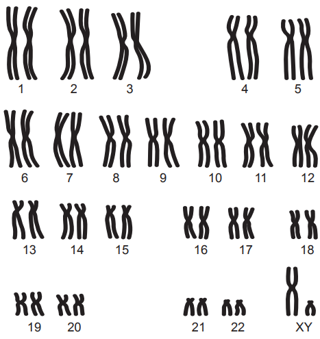 Diagram of human chromosomes arranged in pairs, labelled 1 to 22 and XY, depicting the typical male karyotype for genetic analysis.