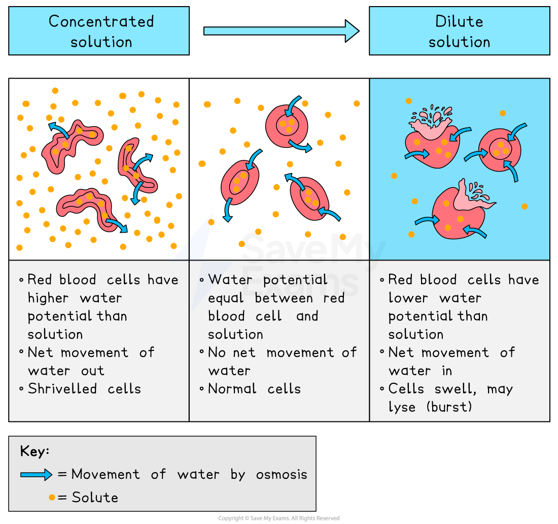 Diagram of osmosis effects on red blood cells in concentrated, isotonic, and dilute solutions, showing cell changes and net water movement.
