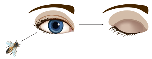Diagram of a bee approaching an eye, causing it to close. Arrows indicate the movement and the reaction of the eye to the bee.