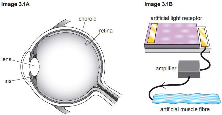 Cross-section diagram of an eye showing lens, iris, choroid, and retina next to an artificial light receptor setup with amplifier and muscle fibre.