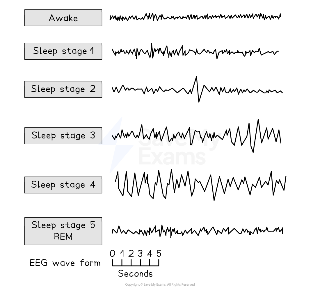 Chart showing EEG waveforms for awake state and sleep stages 1 to 5, with increasing amplitude and variability in later stages, labelled by seconds.