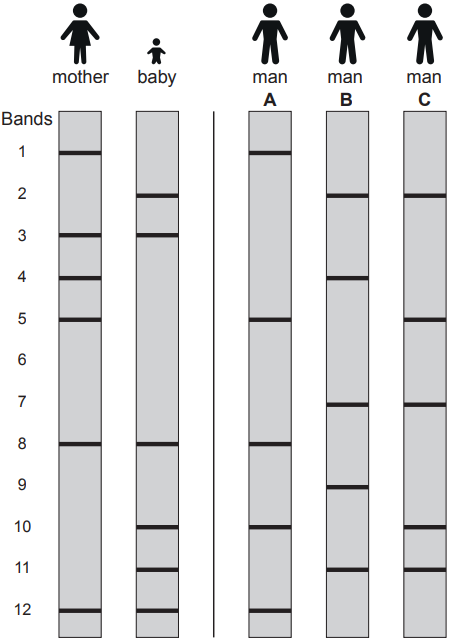 DNA profiling chart with band patterns for mother, baby, and three men (A, B, C). Bands are numbered 1 to 12, comparing genetic markers.