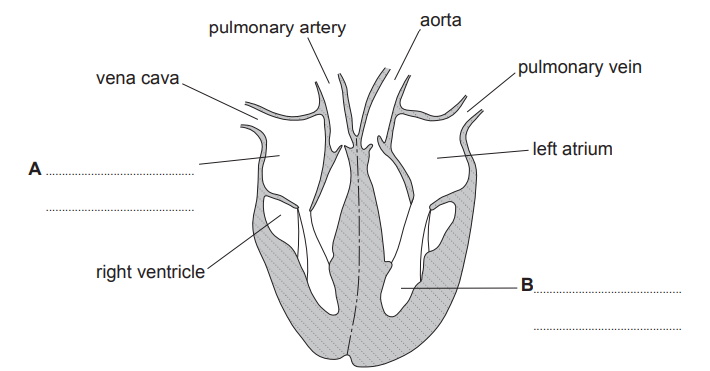 Diagram of heart anatomy showing vena cava, right ventricle, left atrium, pulmonary artery, vein, and aorta, with labels A and B marking cavities.