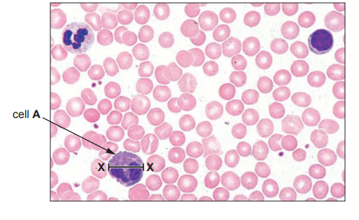 Microscopic view of blood cells, with a labelled cell A identified by an arrow. The image shows various round, pink blood cells and a few darker stained cells.