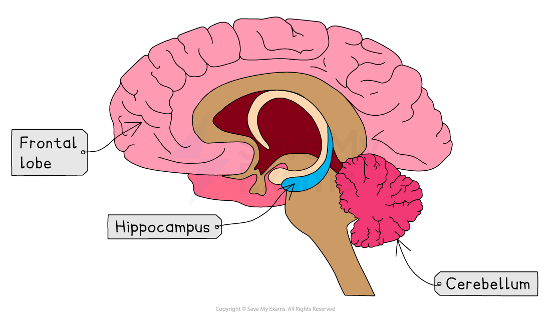 Cross-section of a brain highlighting the frontal lobe, hippocampus, and cerebellum, labelled with distinct colours and arrows.