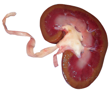 Cross-section of a kidney displaying the ureter, with visible cortex and medulla, highlighting internal anatomy and structure in detail.