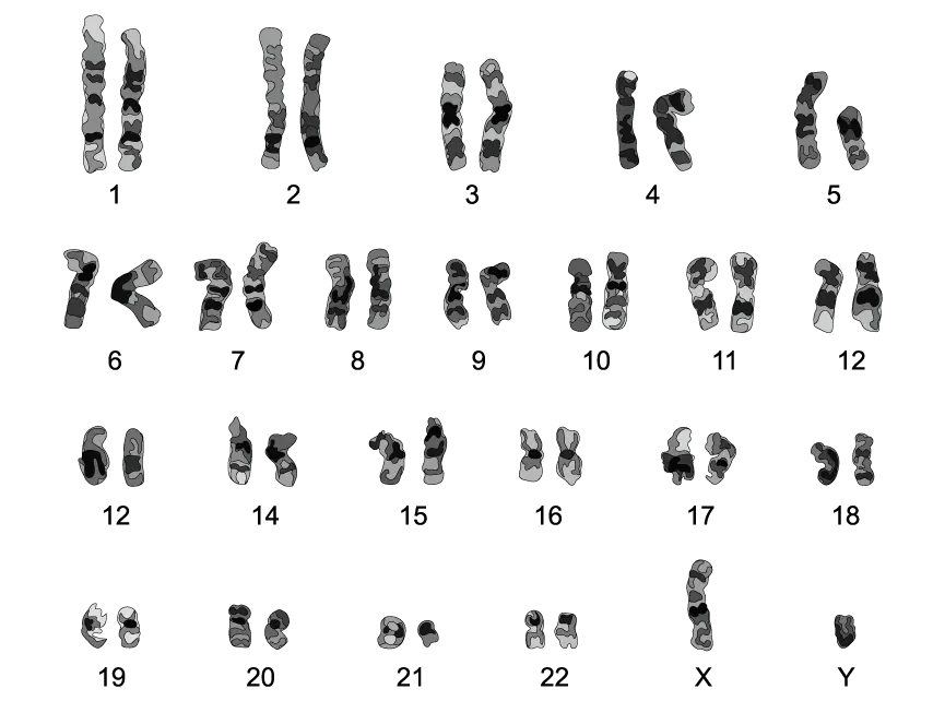 Diagram showing a human karyotype with 23 pairs of chromosomes labelled 1 to 22 and X, Y, each with distinct banding patterns for genetic analysis. Pair 5 has one chromosome that is shorter than the other.