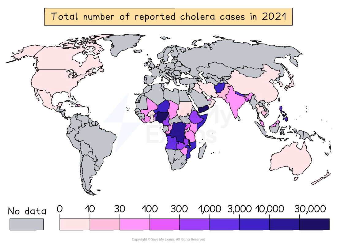 World map showing cholera cases in 2021 by country, colour-coded: grey (no data) to dark purple (up to 30,000 cases). Highest cases in Africa.