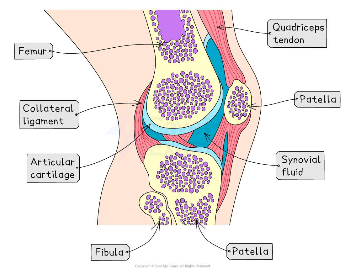 Diagram of a knee joint, showing the femur, fibula, tibia, patella, quadriceps tendon, collateral ligament, articular cartilage, and synovial fluid.