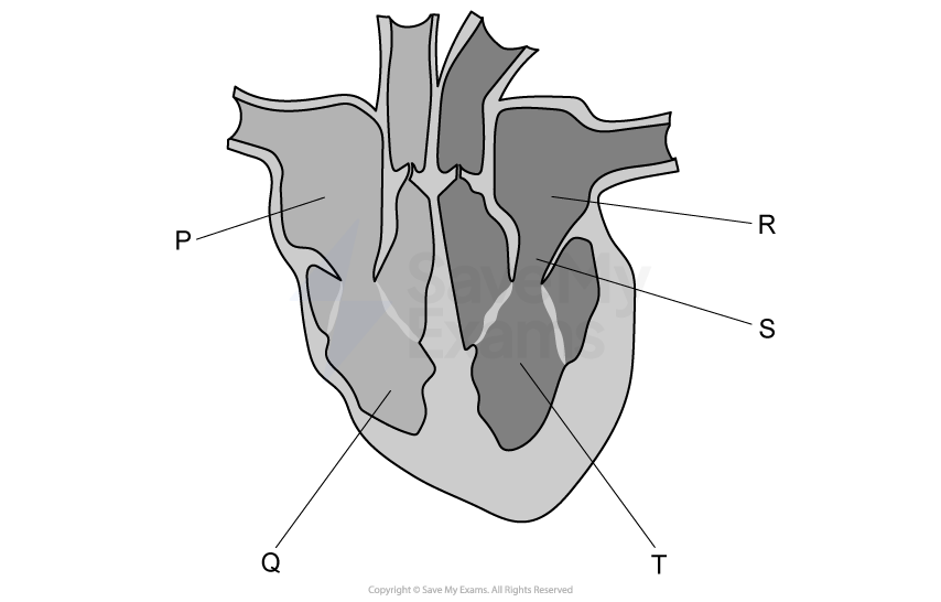 Diagram of a human heart with labelled sections: P, Q, R, S, and T. Arrows indicate blood flow through the heart's chambers and vessels.