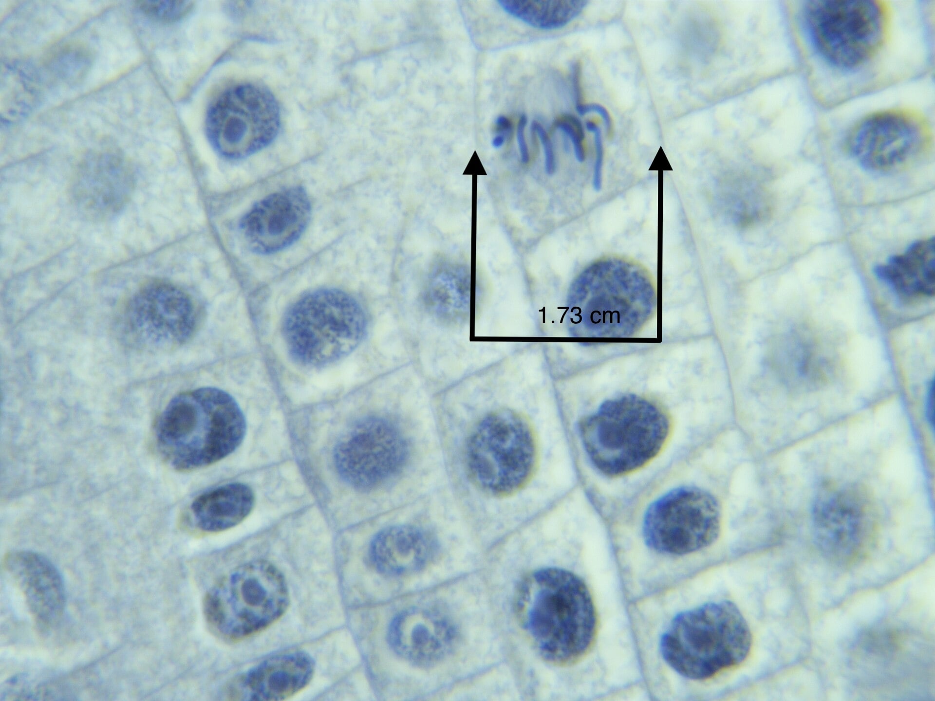 Microscopic view of plant cells showing nuclei, with an arrow indicating a 1.73 cm measurement. Cells are arranged in a grid-like pattern.
