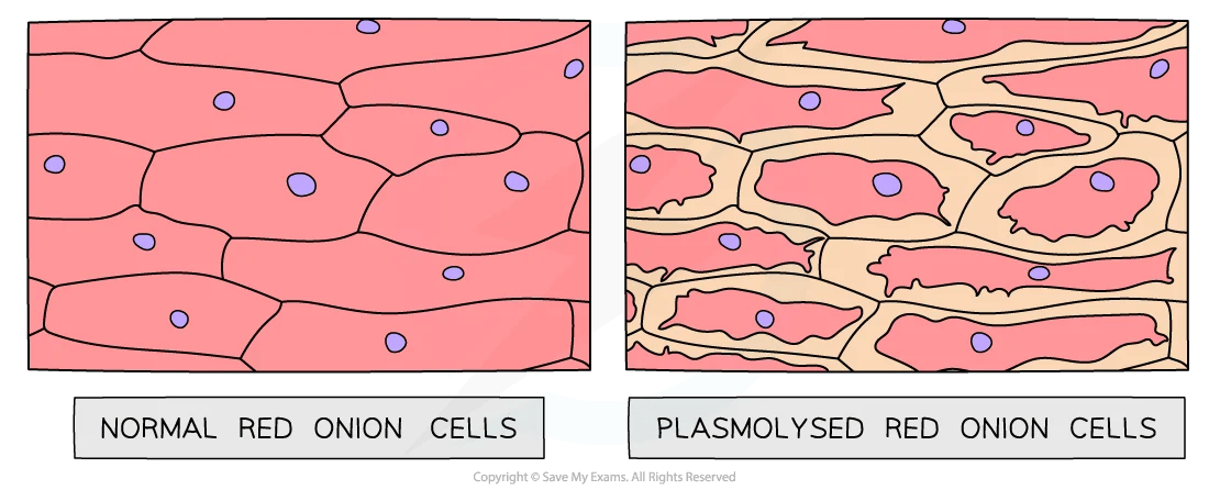 Comparison of normal and plasmolysed red onion cells; normal cells appear intact, while plasmolysed cells show shrunken membranes and empty spaces.