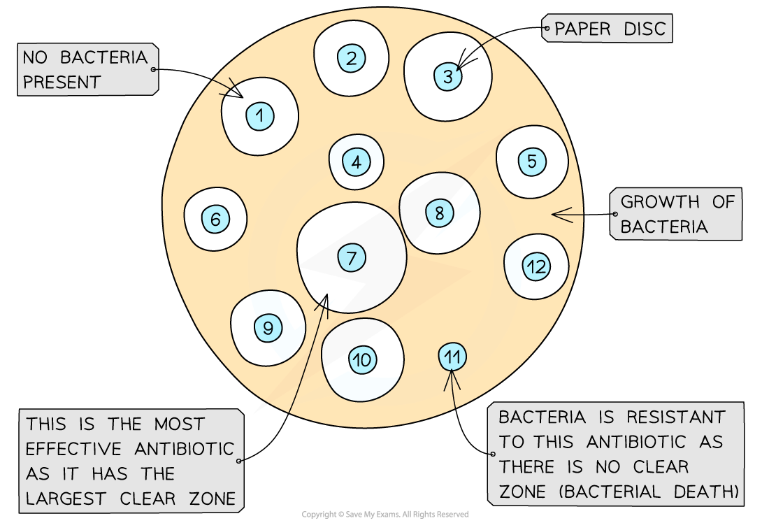 Diagram of antibiotic effectiveness on bacteria, showing clear zones around discs indicating no bacteria and resistance where no clear zones exist.
