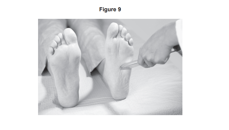Doctor using a blunt instrument to test sensation on the sole of a patient’s bare foot while the patient lies on an examination couch