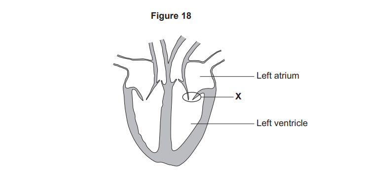 Diagram of a vertical section of the heart showing the left atrium, left ventricle and a labelled structure X between them, likely the bicuspid valve.