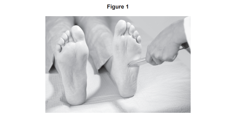 Clinician performs reflex test on patient’s bare foot, gently stroking the sole with a blunt instrument while patient lies on an examination couch