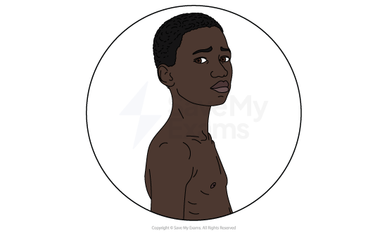 Nwoye