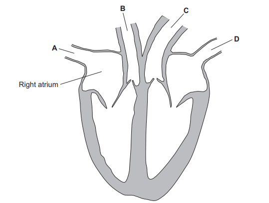 Figure 1: cross-section of the human heart with the right atrium labelled and four major blood vessels labelled A, B, C, D entering or leaving the top of the heart. A is the rightmost upper vessel (vena cava), B is the next major vessel (pulmonary artery), C is the large vessel on the patient’s left (aorta), and D is the upper-left vessel (pulmonary vein).