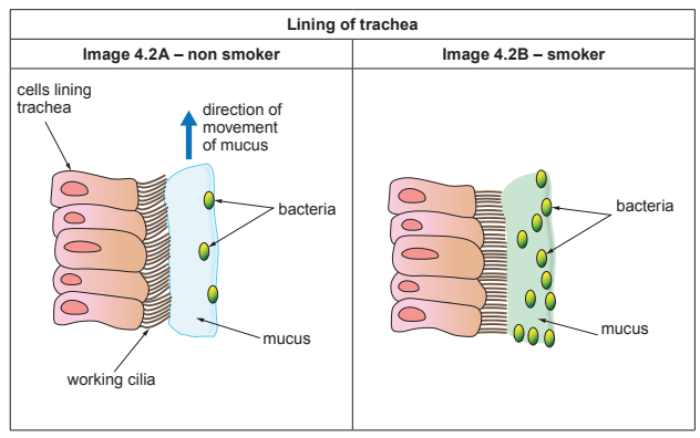 Image  4.2A - non smoker
[Figure: Diagram of cells lining the trachea in a non-smoker, showing working cilia moving mucus containing bacteria in a direction of movement towards the throat]

Image 4.2B – smoker

[Figure: Diagram of cells lining the trachea in a smoker, showing mucus and bacteria present without the cilia actively moving them]