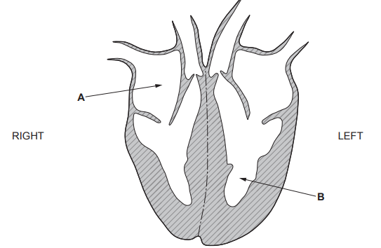 [Figure: diagram of a cross-section through a human heart, labelled LEFT and RIGHT, with chambers A and B indicated]