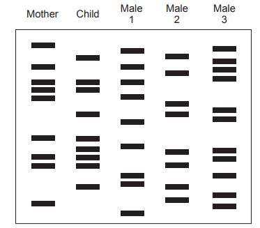 ![Figure: DNA gel electrophoresis genetic profile diagram showing 5 lanes labelled Mother, Child, Male 1, Male 2, Male 3, each with a pattern of horizontal DNA bands]