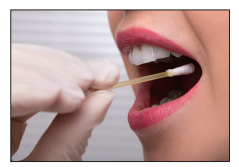 [Figure: photograph of a person using a swab to remove cheek cells from another person's mouth, wearing gloves]