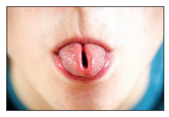 Close-up of a person’s mouth showing the tongue curled into a tube shape with a central slit, against a blurred background