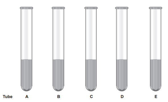 [Figure: Five test tubes (A-E) each containing 5 cm3 of 1% protein solution. Tube A: plus 5 cm3 of 0.1% protease, pH 2.0. Tube B: plus 15 cm3 of liquid from the stomach. Tube C: plus 5 cm3 of 0.1% protease and 10 cm3 distilled water, pH 7.0. Tube D: plus 15 cm3 distilled water, pH 2.0. Tube E: plus 10 cm3 distilled water, pH 7.0]