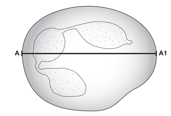 [Figure: Drawing of a white blood cell, with a line labelled A to A1 drawn across its width]