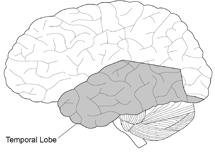 Side-view diagram of the brain facing left, with the lower temporal lobe shaded grey and labelled “Temporal Lobe”; the other lobes and cerebellum are shown in outline.