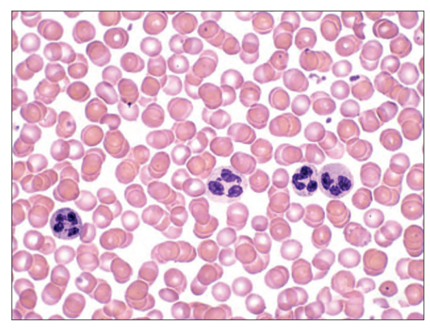[Figure: Photograph of a blood smear viewed under high power magnification of a light microscope, showing stained red and white blood cells]