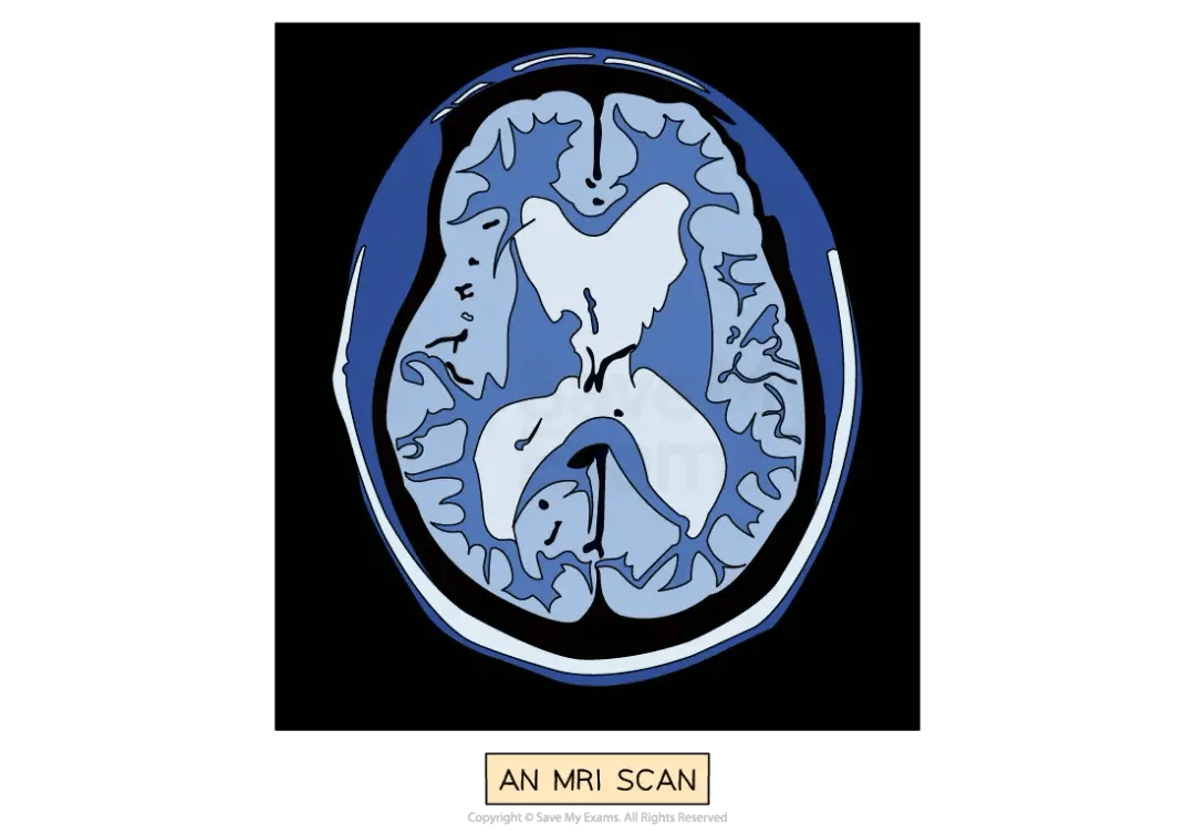 An MRI scan of a cross-section through the human brain, showing the folded cerebral cortex and contrasting internal brain regions. The image is labelled “AN MRI SCAN”.